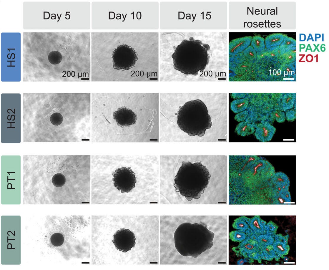 Bright-field images of human (HS1 and HS2) and chimpanzee (PT1 and PT2) organoids at days 5, 10, and 15. Right: Immunofluorescence images of day 15 neural rosettes stained for PAX6 (green), ZO1 (red), and DAPI (blue).