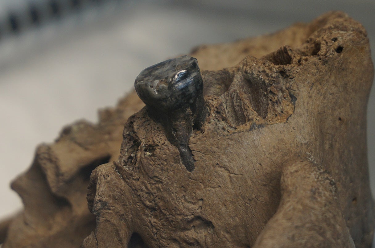 Researchers recovered ancient DNA from dental plaque on a skeleton’s only surviving molar. 