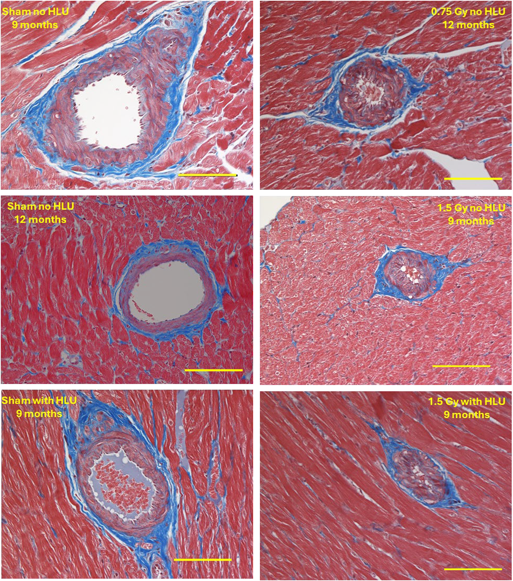 Structural changes in the heart 270 days and 360 days after simGCRsim and HLU or sham irradiation no HLU.