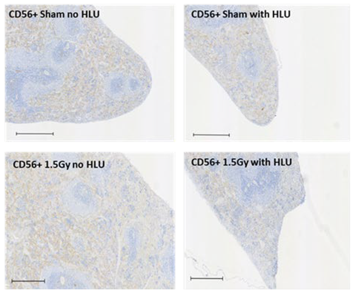 Depletion of components of the immune system in spleen. Areas positive for biomarkers of natural killer cells (CD56+) in spleen 270 days after sham irradiation no HLU, sham irradiation with HLU, whole body exposure to simGCRsim no HLU, and simGCRsim with HLU.