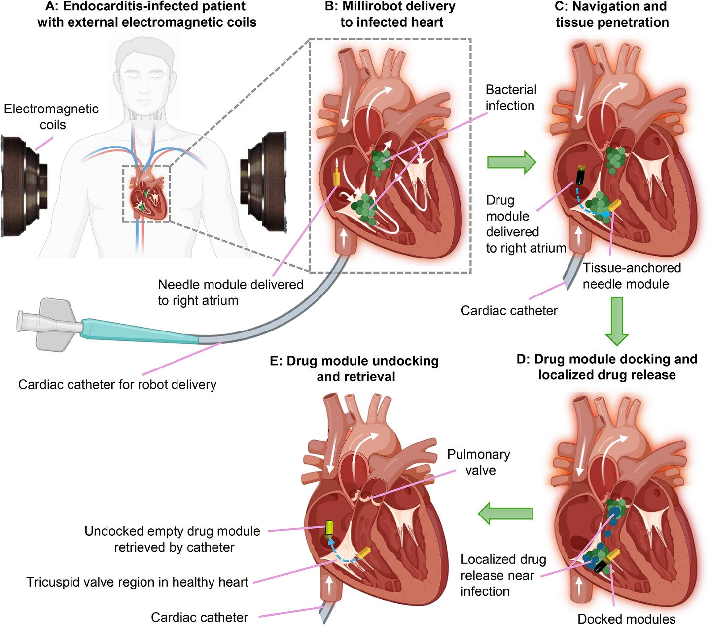 Schematic overview of how the proposed modular cardiac drug delivery system would work in vivo. 