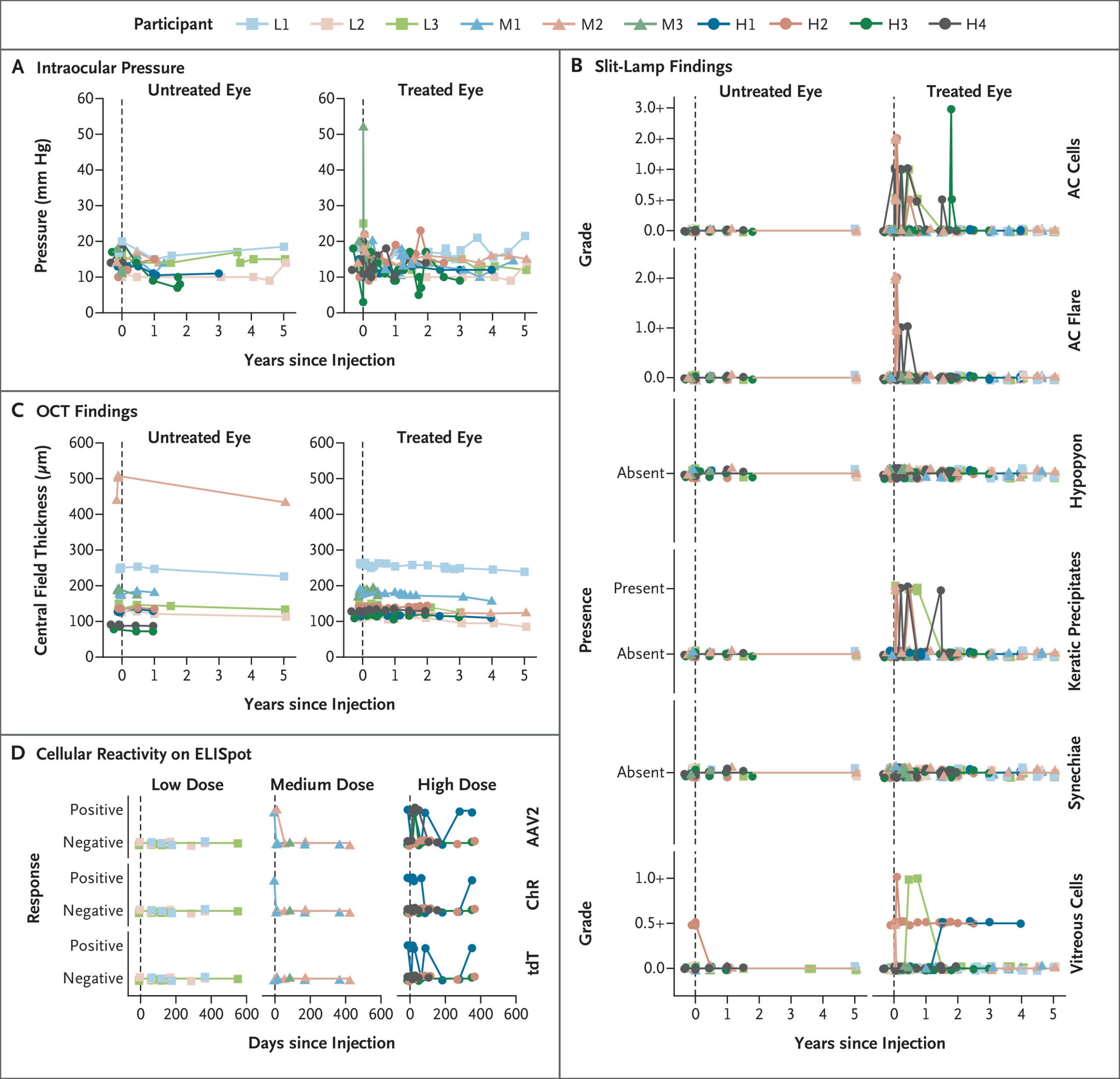 Safety assessments tracked eye pressure, inflammation, retinal thickness, and immune responses throughout the study. Inflammation was graded from 0 to 4+, while immune activity was measured against AAV2, ChrimsonR, and tdTomato. Participants received low (5.0 × 10¹⁰), medium (1.5 × 10¹¹), or high (5.0 × 10¹¹) doses of vector genomes per eye.