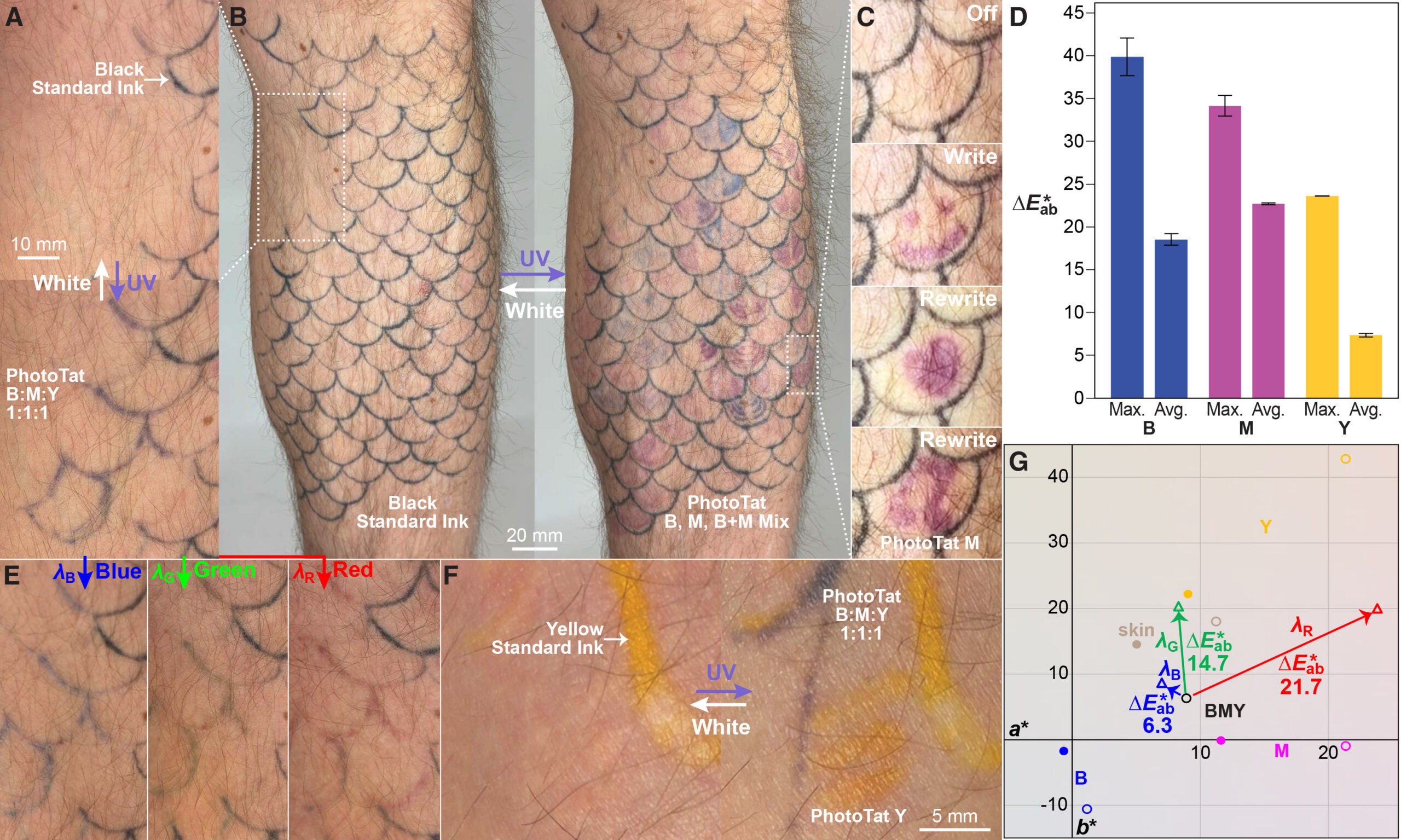 Single-subject in vivo pilot of PhotoTat in human skin (Fitzpatrick type II), 1.4–2.2 years after implantation