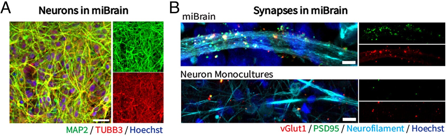 Neuronal and vascular phenotypes enabled by the miBrain. (A) Characterization of neurons integrated into miBrain immunohistochemistry [green: microtubule-associated protein 2 (MAP2), red: TUBB3, blue: Hoechst]; (Scale bar, 30 µm). (B) Synapses in miBrain (Top) versus neuronal monocultures (Bottom)