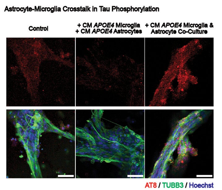 Tau phosphorylation in APOE4 miBrains treated with (Left) media only, (Middle) monoculture CM, (Right) coculture CM, coadministered with exogenous Aβ 1-42 (red: AT8, green: TUBB3, blue: Hoechst). 